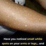 Taking Atorvastatin? 15 Hidden Side Effects You Might Not Know About
