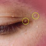 Discovering the 10 Most Common Side Effects of Metoprolol: A Helpful Guide for Anyone Taking This Medication