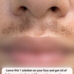 The Real Causes of Constant Phlegm and Mucus in Throat and How to Get Rid of It!