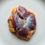 Warning Symptoms That Could Suggest Fatty Liver Problems in Early Stages