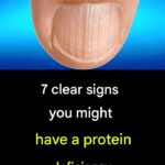 How to remove uric acid and treat joint inflammation