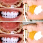 Keep these tips in mind to avoid visiting the dentist