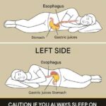 Why You Keep Waking Up With a Dry Mouth