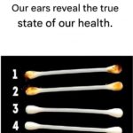 If you have lines on your nails, it means you have ca…See more
