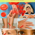 Important Warning from Doctors: Stop Taking Vitamin D Immediately If You Have These 4 Symptoms