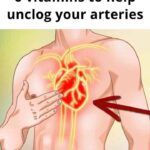 If your veins are visible in your hand, it is a signal of ca…