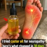 Who Is Most at Risk of Night Cramps?