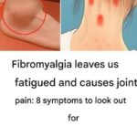 FIBROMYALGIA: The Disease of Unexpressed Emotions