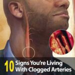 Eight pills you shouldn’t take because they damage your kidneys