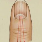 7 Signs of Arthritis You Shouldn’t Ignore