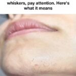 Warning signs of blood clots