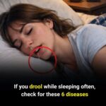 If you have visible veins, it means you are… See more
