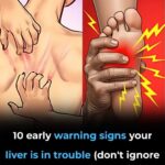 Metoprolol: The Good, The Bad, and The UGLY – Your No-BS Guide to 10 Common Side Effects