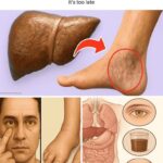 These are the first symptoms of a… See more