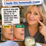 # Early Signs of Vascular Dementia (Most People Miss #3) – What Your Brain Is Quietly Telling You Before It’s Too Late