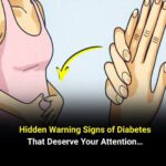 If your veins are visible in your hand, it is a signal of ca… See