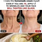 Important Warning from Doctors: Stop Taking Vitamin D Immediately If You Have These 4 Symptoms