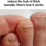 Prepare the baking soda cream and apply it before bed. Goodbye wrinkles and blemishes…see more