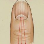 Living with rheumatoid arthritis: daily challenges