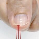 3 areas of the body with persistent itching that could be a wa:rning sign and should not be ignored.
