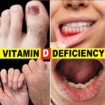 Important Warning from Doctors: Stop Taking Vitamin D Immediately If You Have These 4 Symptoms