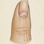 # Pain on the Left Side of the Body: Common Reasons People Experience It and What to Know