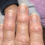 Have you noticed small white spots on your arms or legs… and you don’t know what they are? Here’s what a specialist says check 1st comment