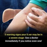 4 Things Your Feet Could Be Telling You About Your Liver Health