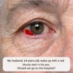 5 Diabetes Symptoms That Appear at Night