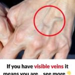 CAUTION if you sleep on your right side…See More