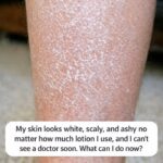 7 Signs of Arthritis You Shouldn’t Ignore