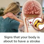10 Early Warning Signs Your Body Might Be Signaling a Stroke (Don’t Ignore These)