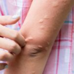 THE MOST POTENT HERB THAT DESTROYS PARASITES, URINARY TRACT & BLADDER INFECTIONS, HERPES, AND FLU VIRUSES
