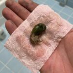 What does the color of your urine say about your health?