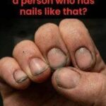 Small White Spots on Arms and Legs You Need To Know
