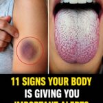 he Vitamin You Need When Your Legs and Joints Are Aching
