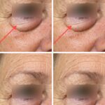 Why Neck Skin Sags as You Age — And What You Can Do About It