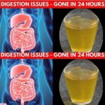 10 Indicators of Blocked Arteries You Shouldn’t Ignore