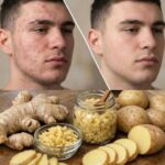 Natural remedy to relieve bone pain and improve mental health