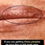 If you notice your legs are swollen, that’s a sign of ca…