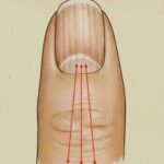 The Real Causes of Constant Phlegm and Mucus in Throat and How to Get Rid of It!