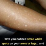 10 Warning Signs of Breast Cancer You Should Never Ignore – Health