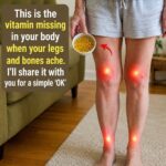 How to Get Rid of Milia: Those Annoying Fat Cysts