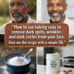 How to Get Rid of Milia: Those Annoying Fat Cysts