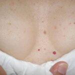 Eliminate fat from arms, belly and backFull article