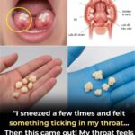 Alert! 8 Drugs That Cause Serious Dementia