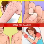 You cut open a watermelon and saw cracks? Stop eating it immediately! Here’s what it means!