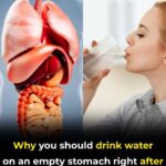The 3 Types of Breakfast That Could Damage Your Kidneys