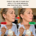 If you have visible veins, it means you are… See more