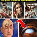 Discovering the 10 Most Common Side Effects of Metoprolol: A Helpful Guide for Anyone Taking This Medication
